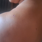 GOTA A GOTA SE ENFRENTAN A VECINOS  CON CUCHILLO  EN BELEN