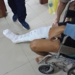 Joven universitario lucha por su pierna tras sufrir grave accidente provocado por motocarrista que se dio a la fuga
