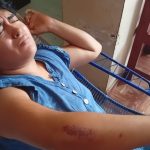 “Tengo miedo de que me mate”: Víctima de apuñalamiento revela los años de tortura vividos bajo el control de su expareja