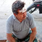 Chofer ebrio causa accidente que deja a mujer con el brazo fracturado y escapa de custodia policial